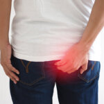 crema para hemorroides