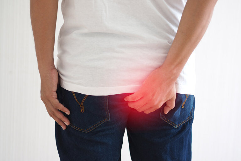 crema para hemorroides