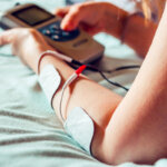 electroestimulación percutánea