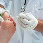 remedio para los hongos en las uñas